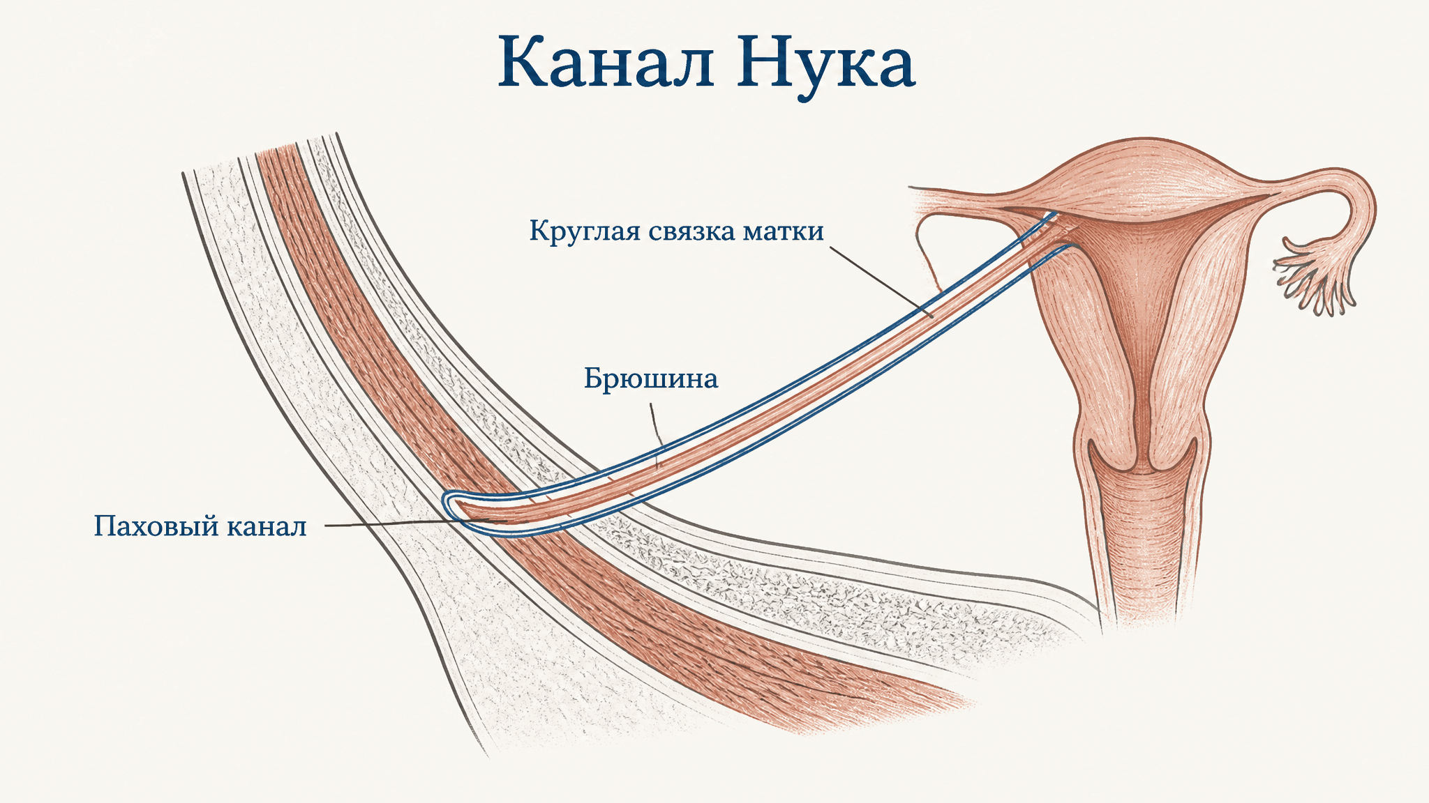 Канал Нука: анатомия, эмбриология и гидроцеле