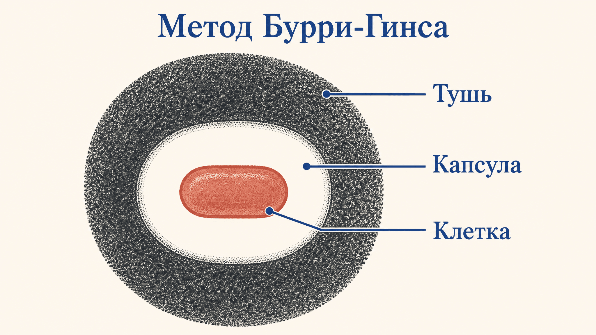 Окраска капсулы по Бурри-Гинсу: метод негативного контраста