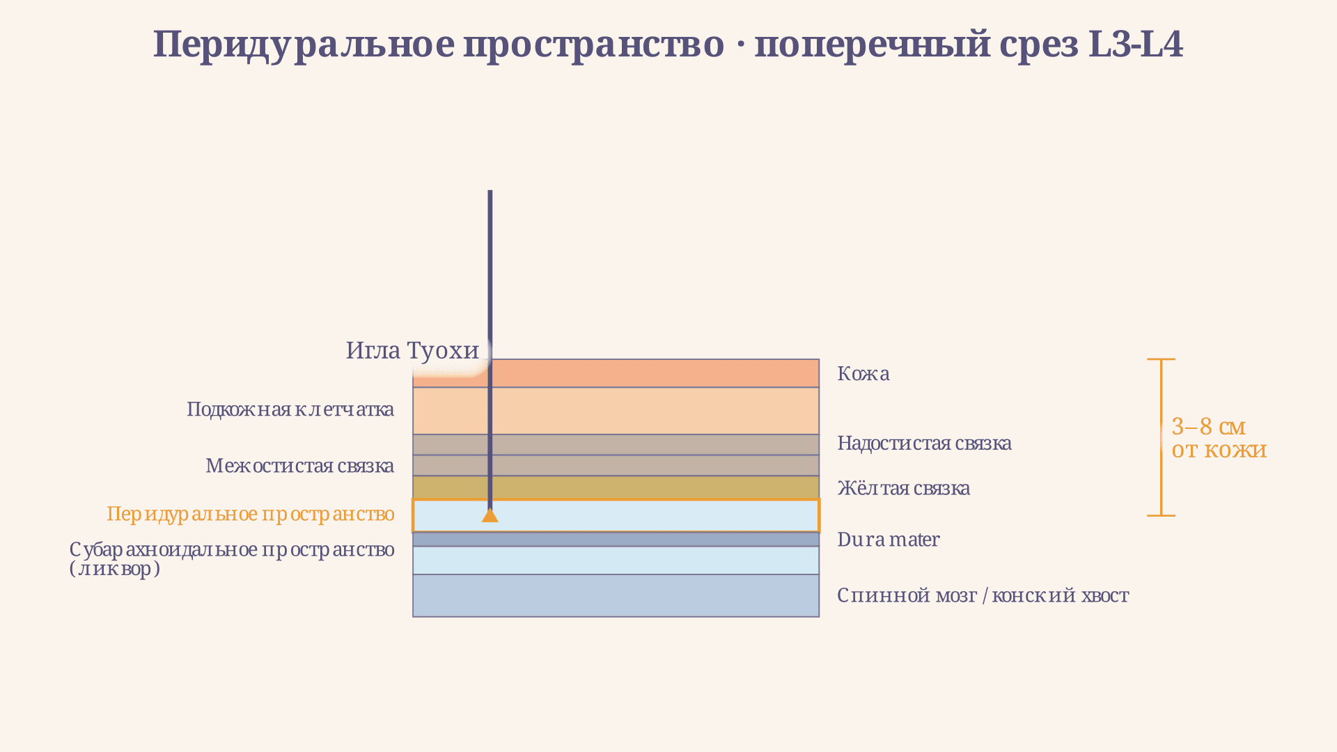 Перидуральное пространство: строение и анестезия