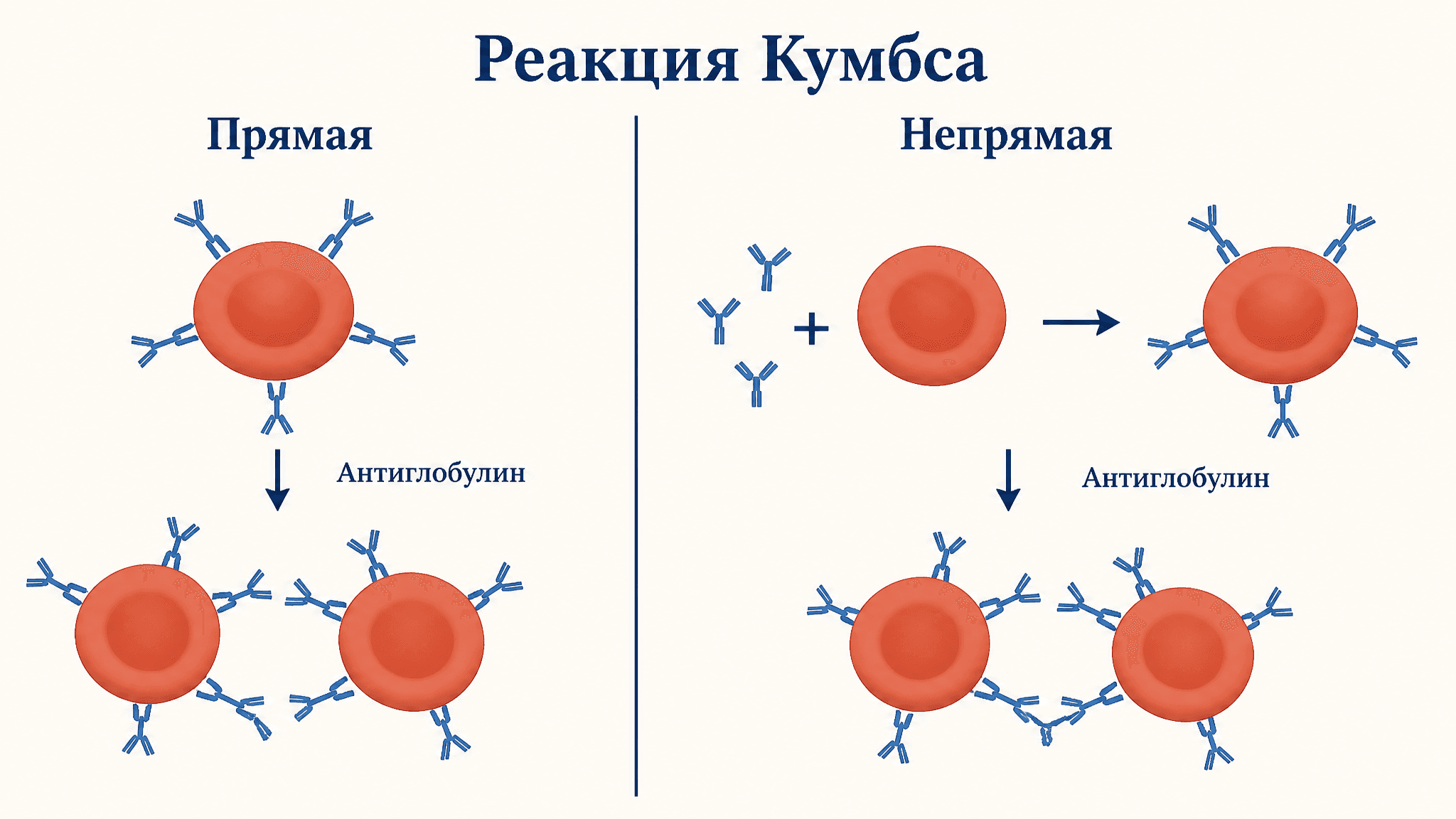 Реакция Кумбса прямая и непрямая: в чём разница