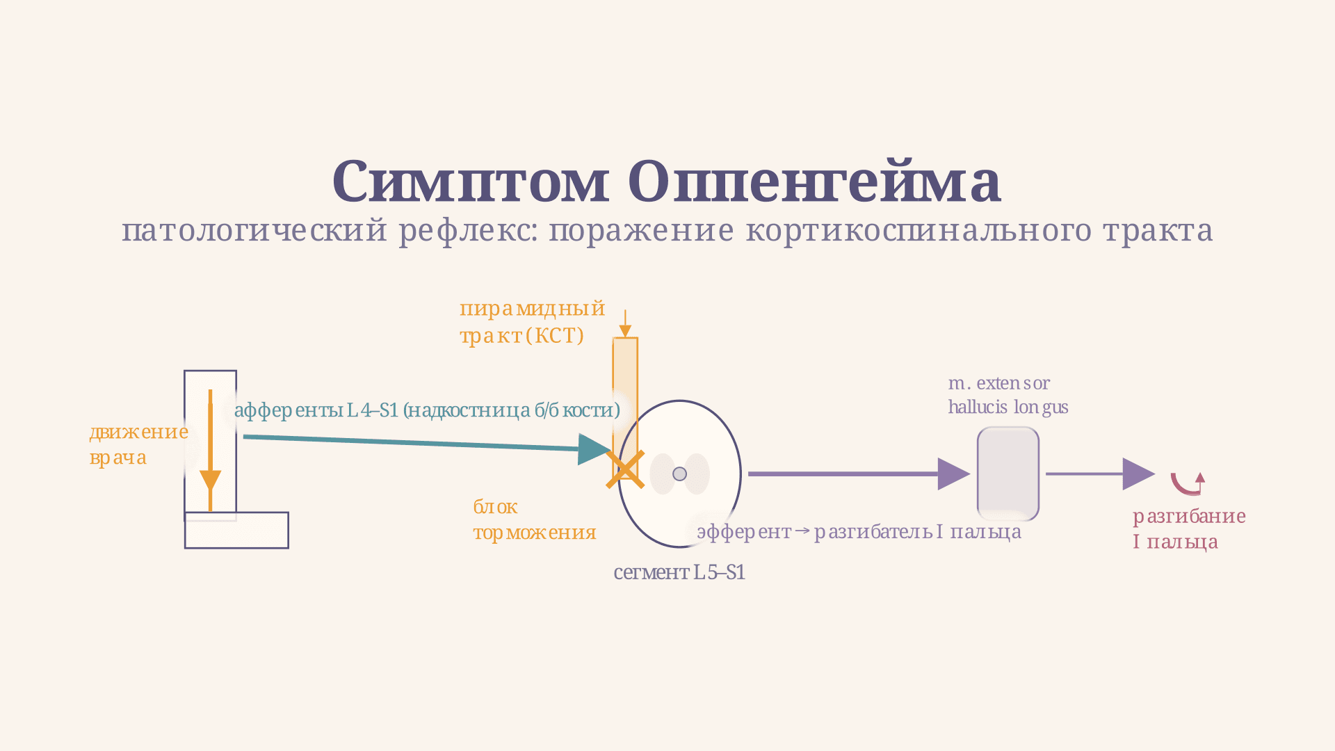 Симптом Оппенгейма: техника и диагностическое значение
