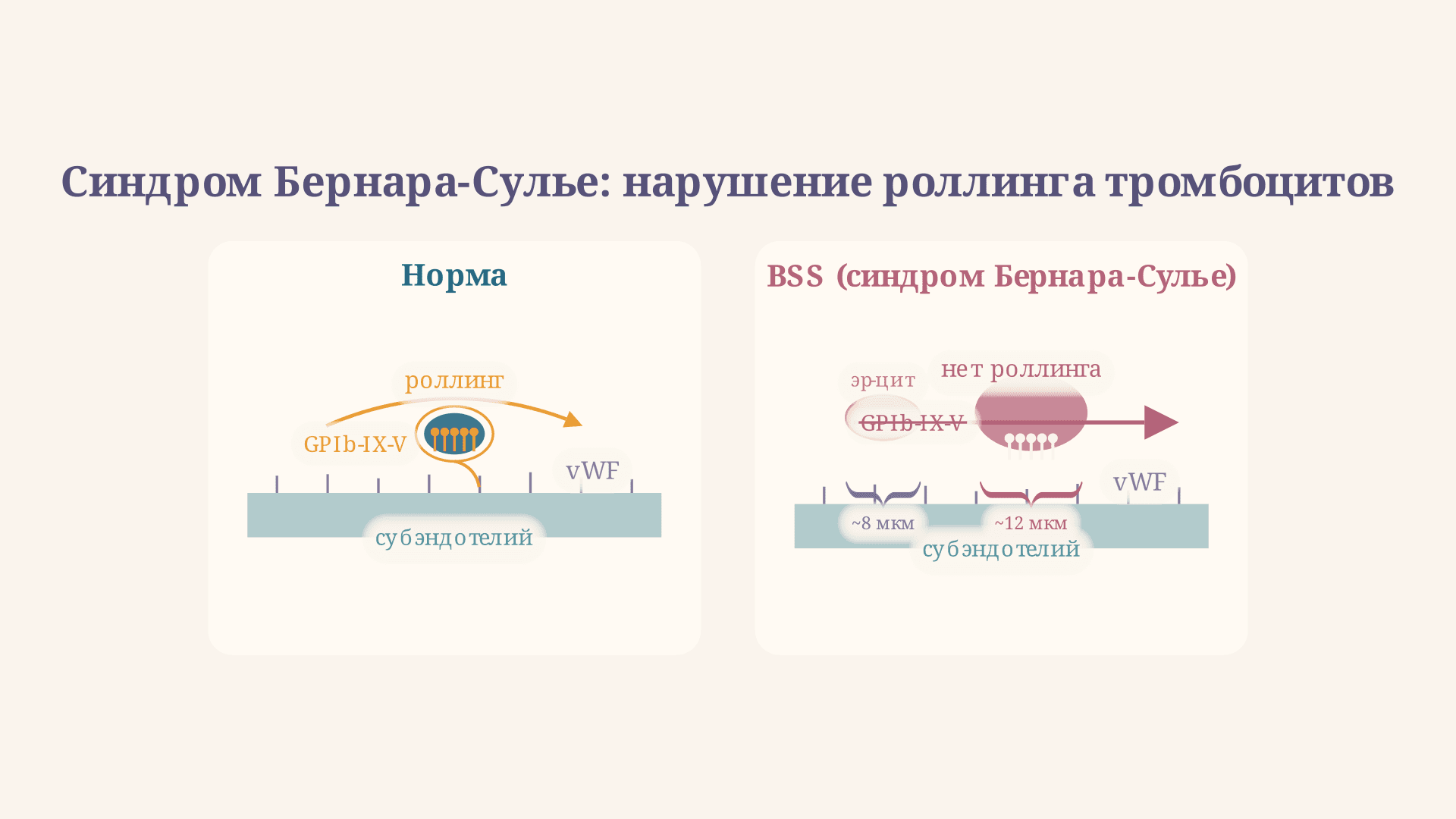 Синдром Бернара-Сулье: диагностика и патогенез