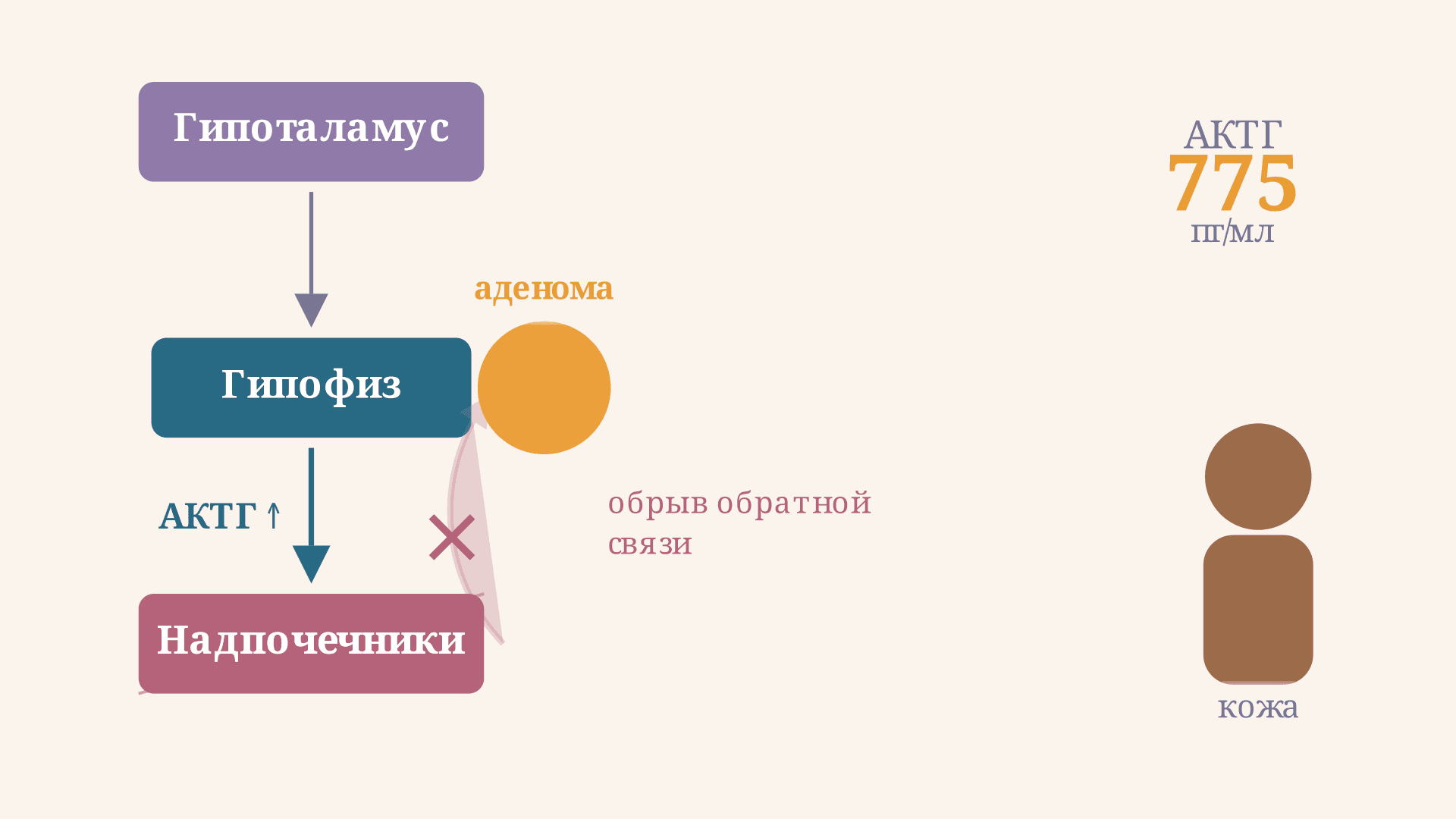 Синдром Нельсона: причины, симптомы и патогенез