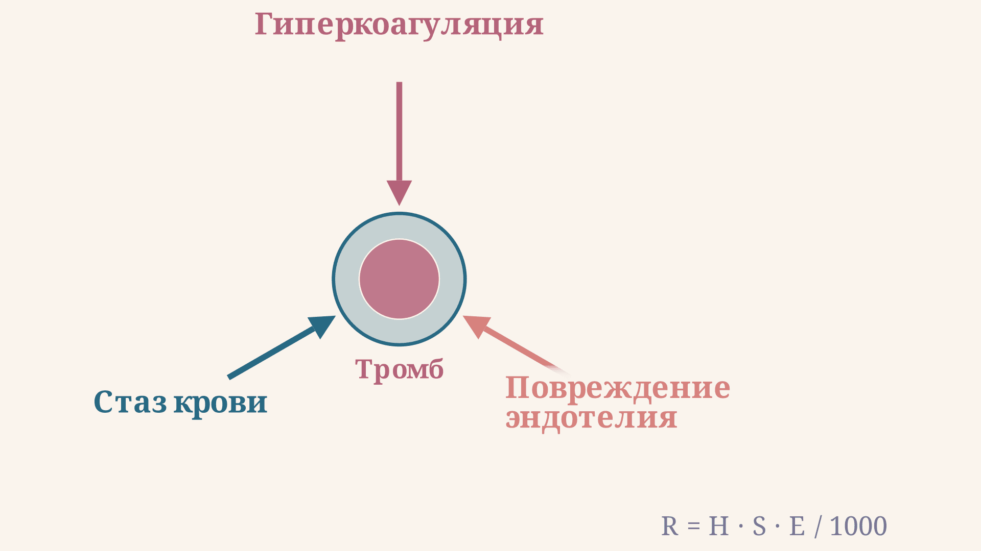 Триада Вирхова: три фактора тромбоза