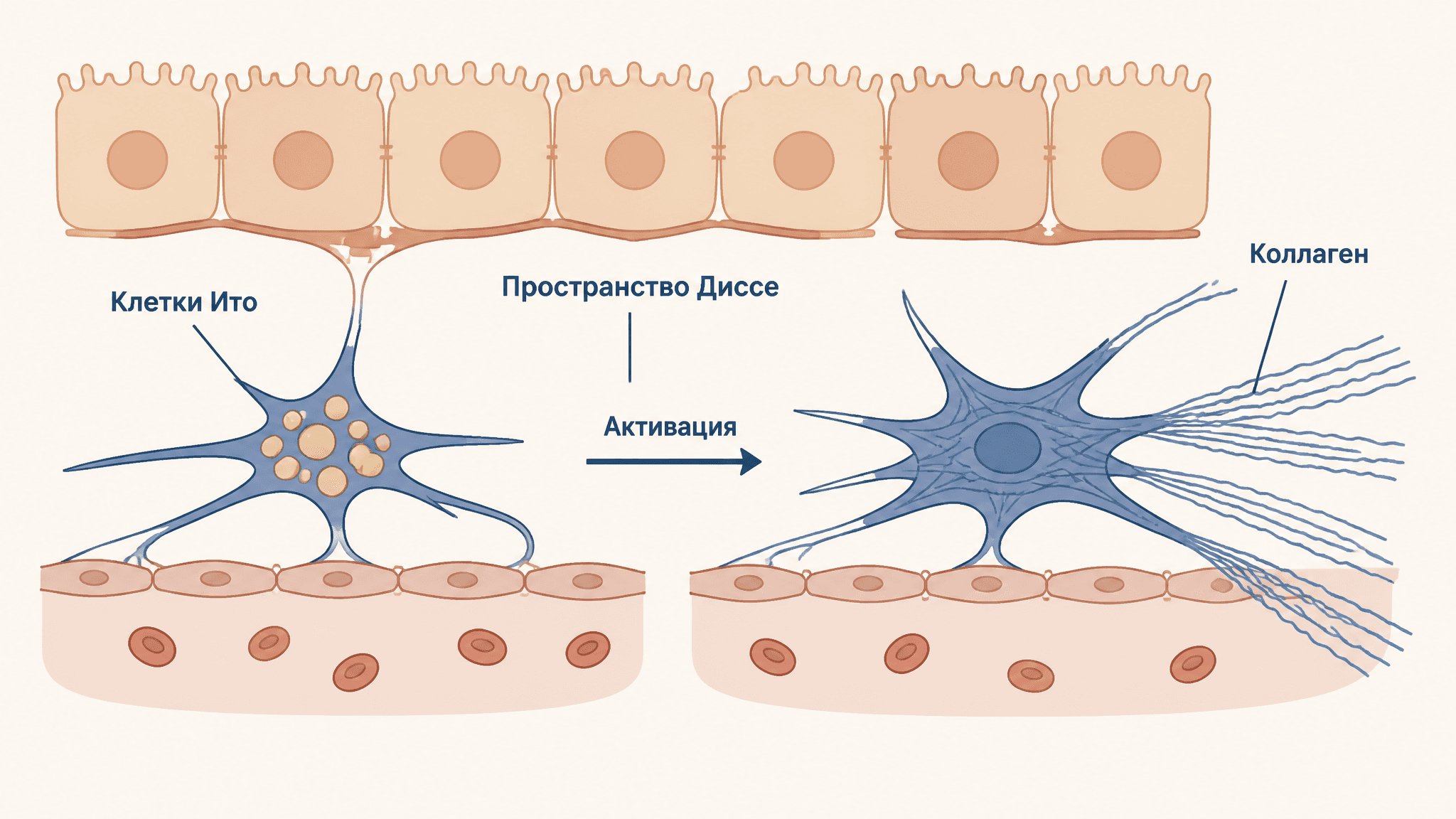 Звёздчатые клетки Ито: хранители и фиброгены печени