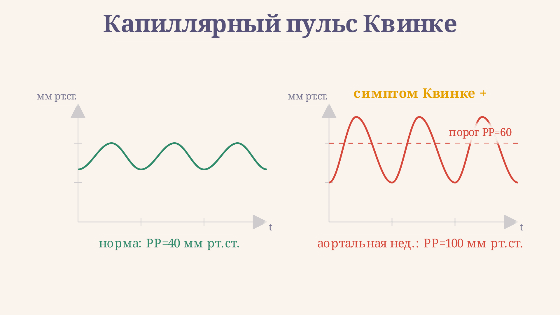 Капиллярный пульс Квинке: симптом и пульсовое давление