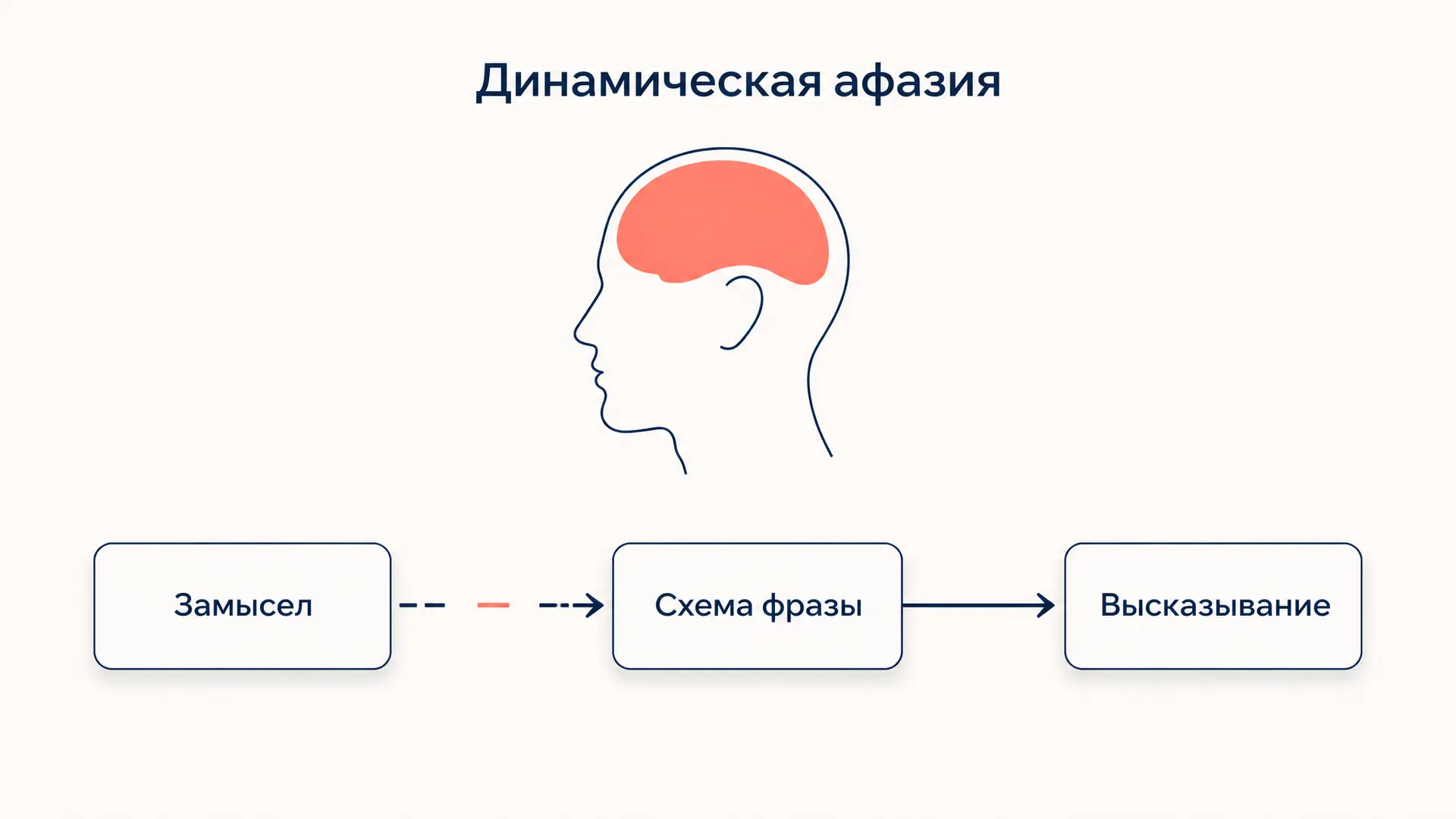 Динамическая афазия по Лурии: дефект и пробы
