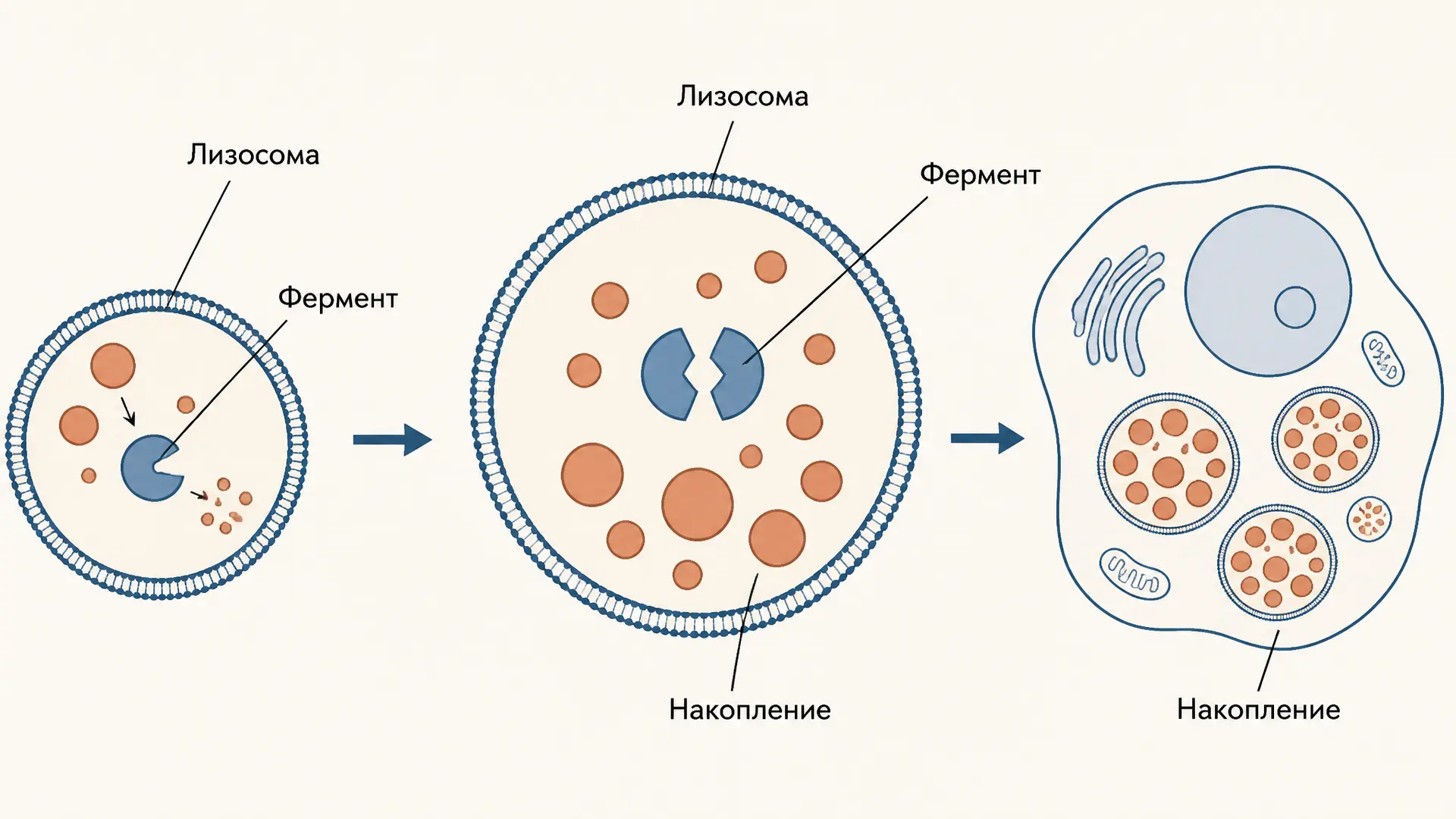 Лизосомные болезни накопления: ферменты и субстраты
