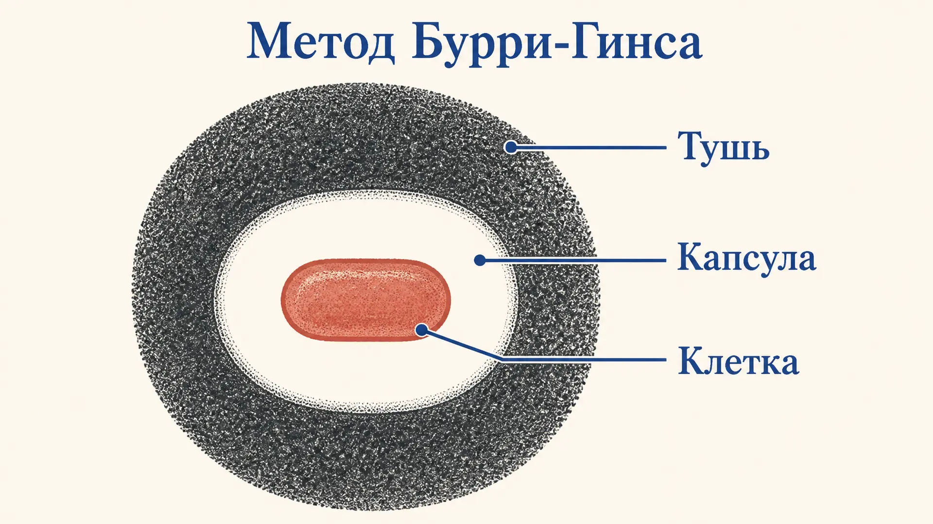 Окраска капсулы по Бурри-Гинсу: метод негативного контраста