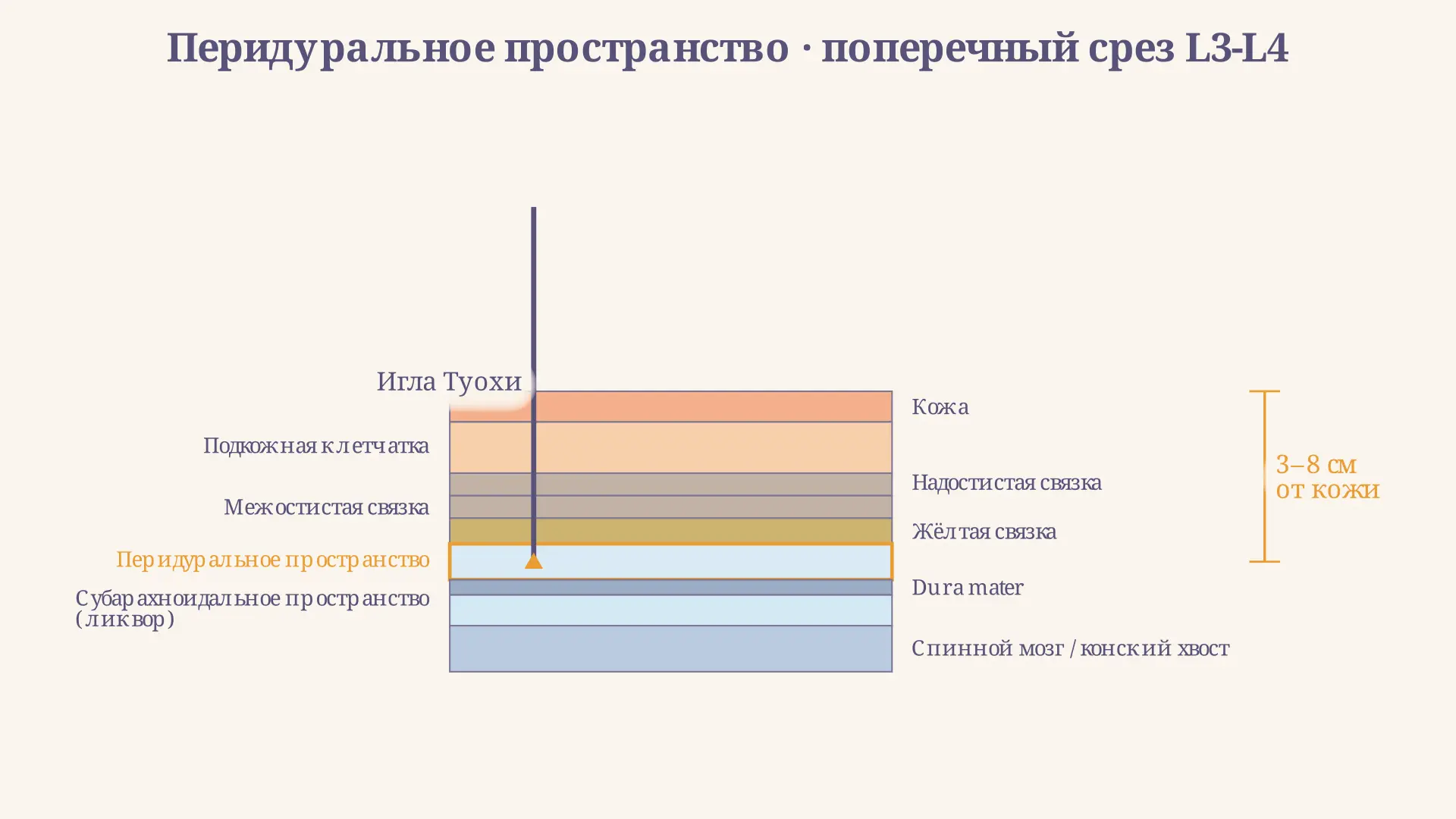 Перидуральное пространство: строение и анестезия