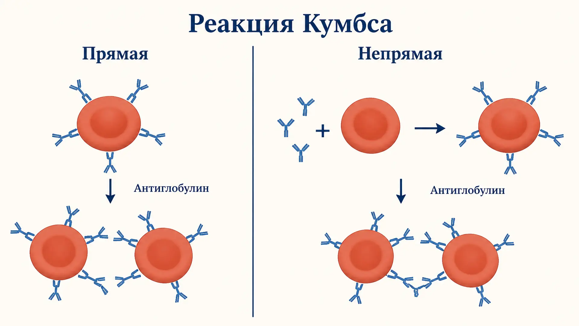 Реакция Кумбса прямая и непрямая: в чём разница