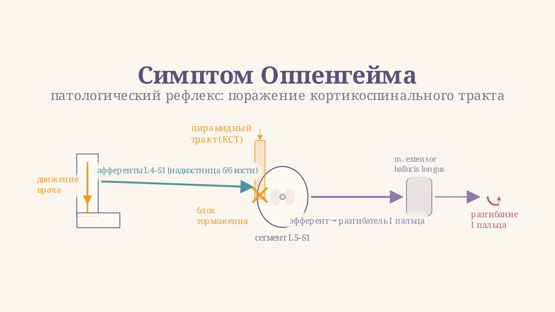 Симптом Оппенгейма: техника и диагностическое значение