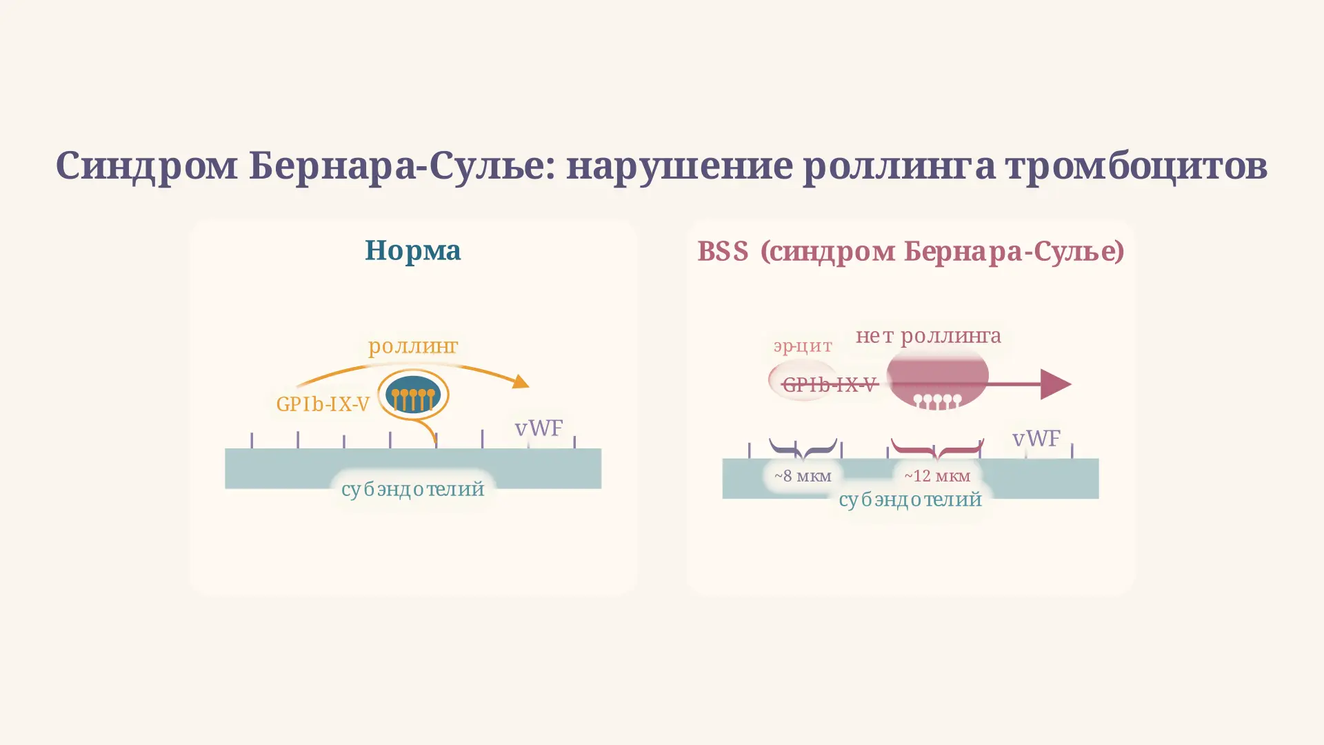 Синдром Бернара-Сулье: диагностика и патогенез