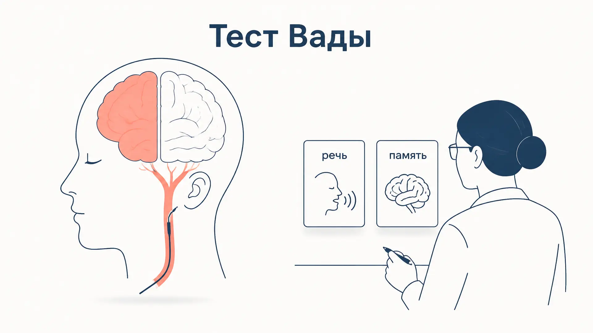 Тест Вады: речевая доминантность перед операцией