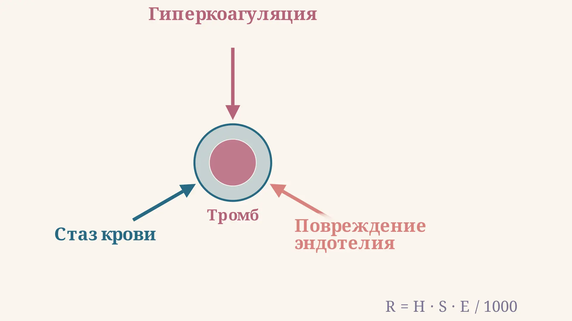 Триада Вирхова: три фактора тромбоза