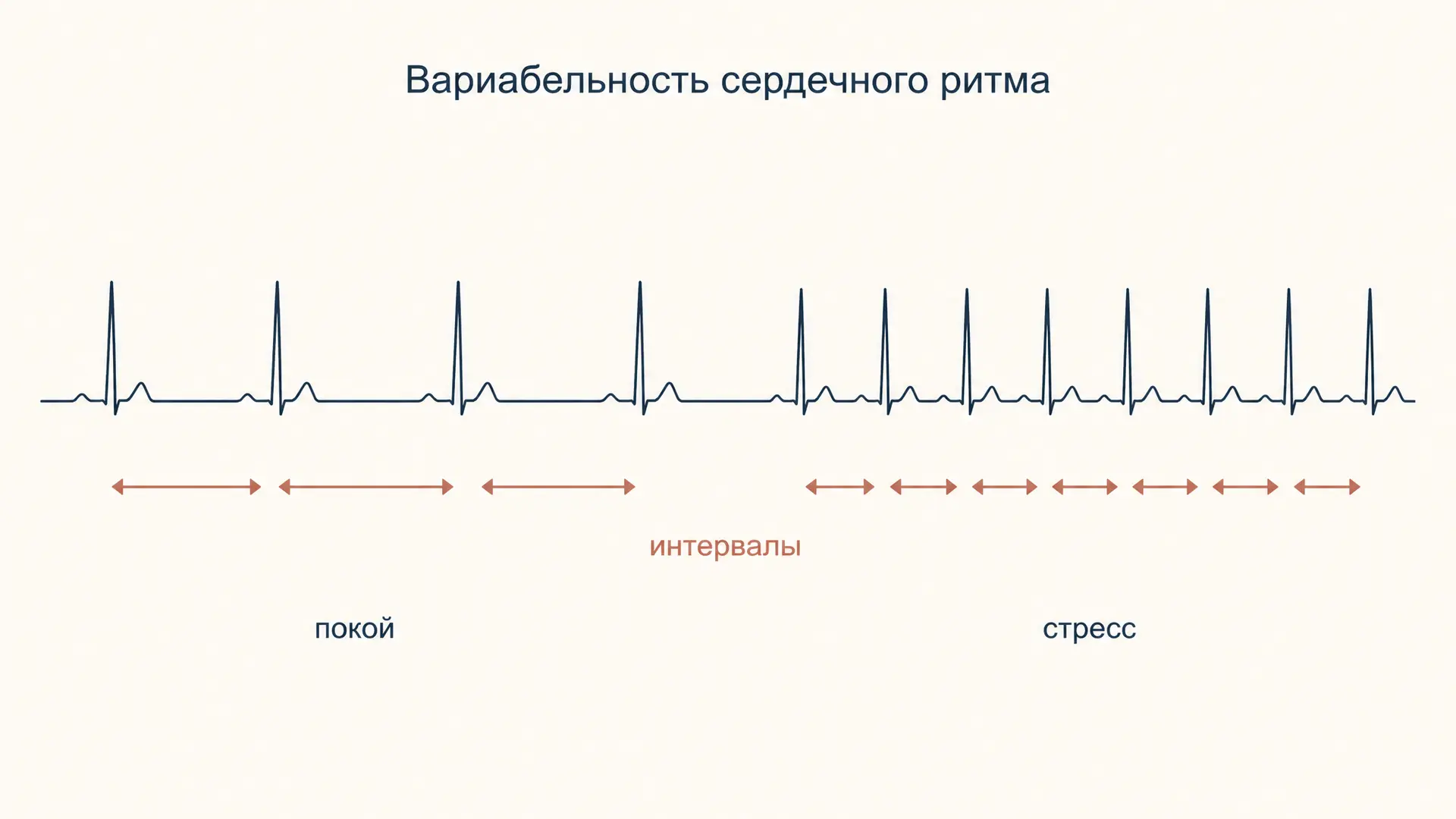 Вариабельность сердечного ритма и стресс: как её меряют