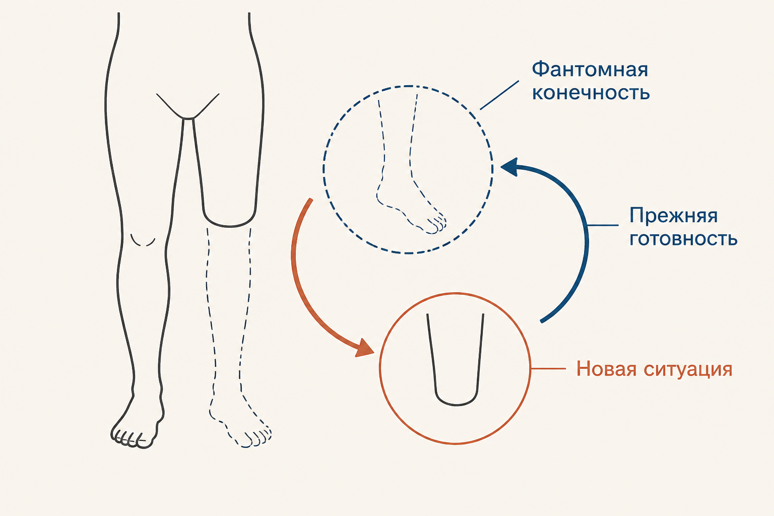 Фантомная конечность как конфликт прежней готовности к движению и новой ситуации
