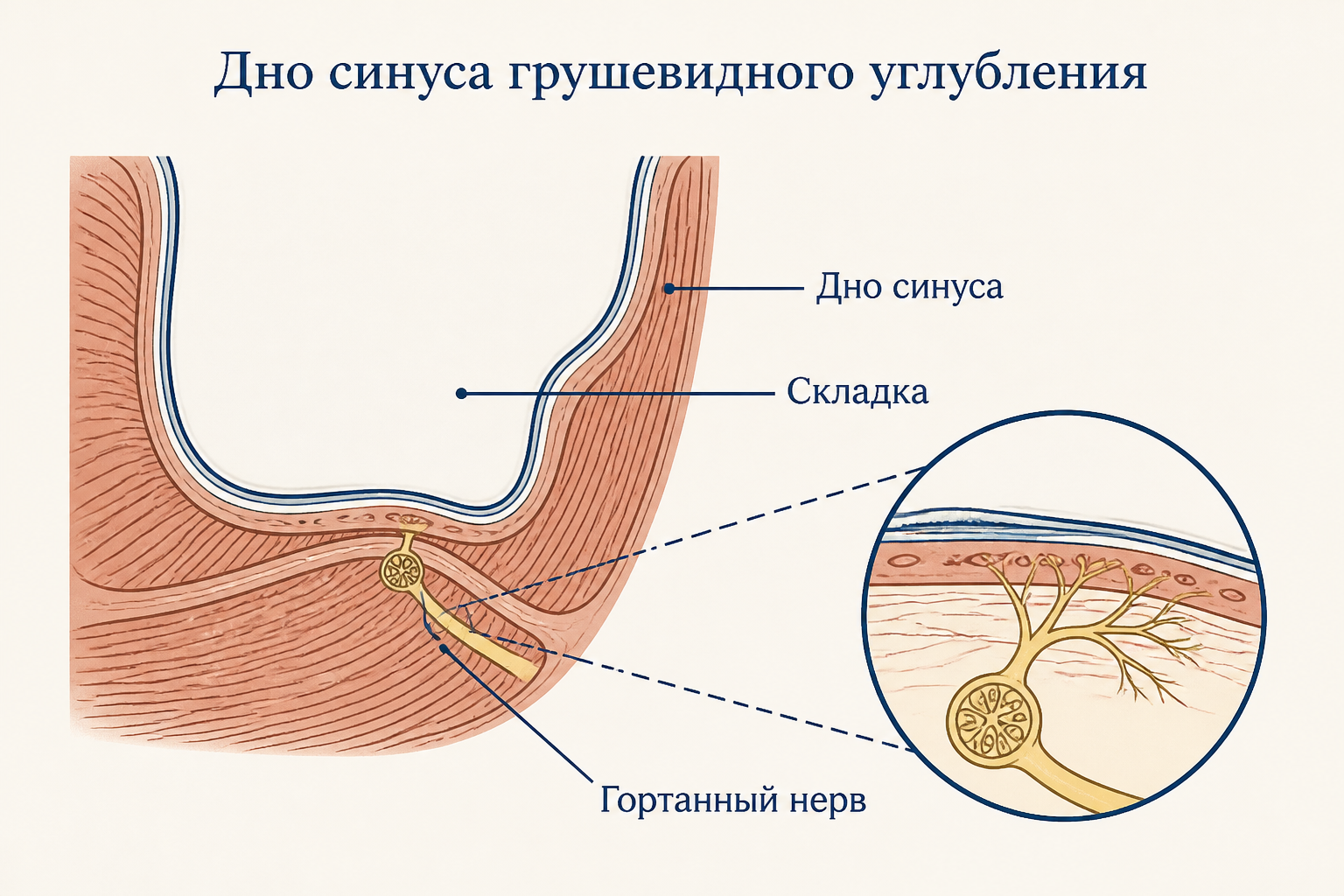 Дно грушевидного синуса в разрезе: тонкая складка слизистой, под которой проходит гортанный нерв; на выноске показано его ветвление