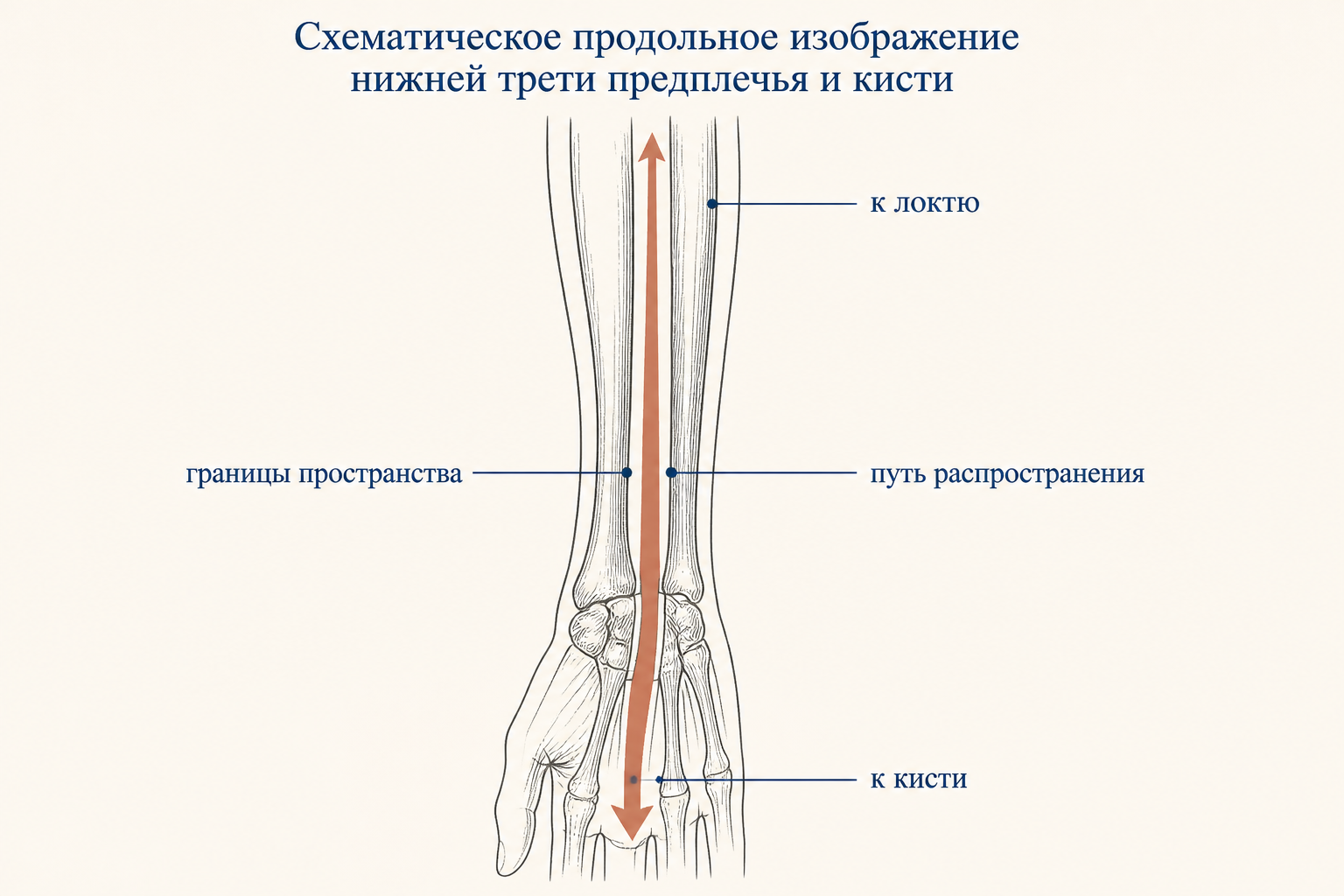 Поперечный срез нижней трети предплечья: между глубокими сгибателями и квадратным пронатором лежит щель пространства Пирогова-Парона