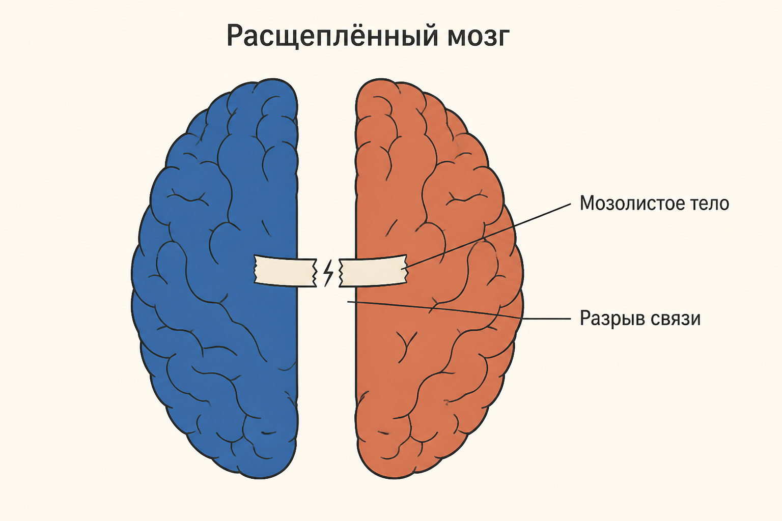 Расщеплённый мозг: после рассечения мозолистого тела каждое полушарие работает со своей половиной поля зрения