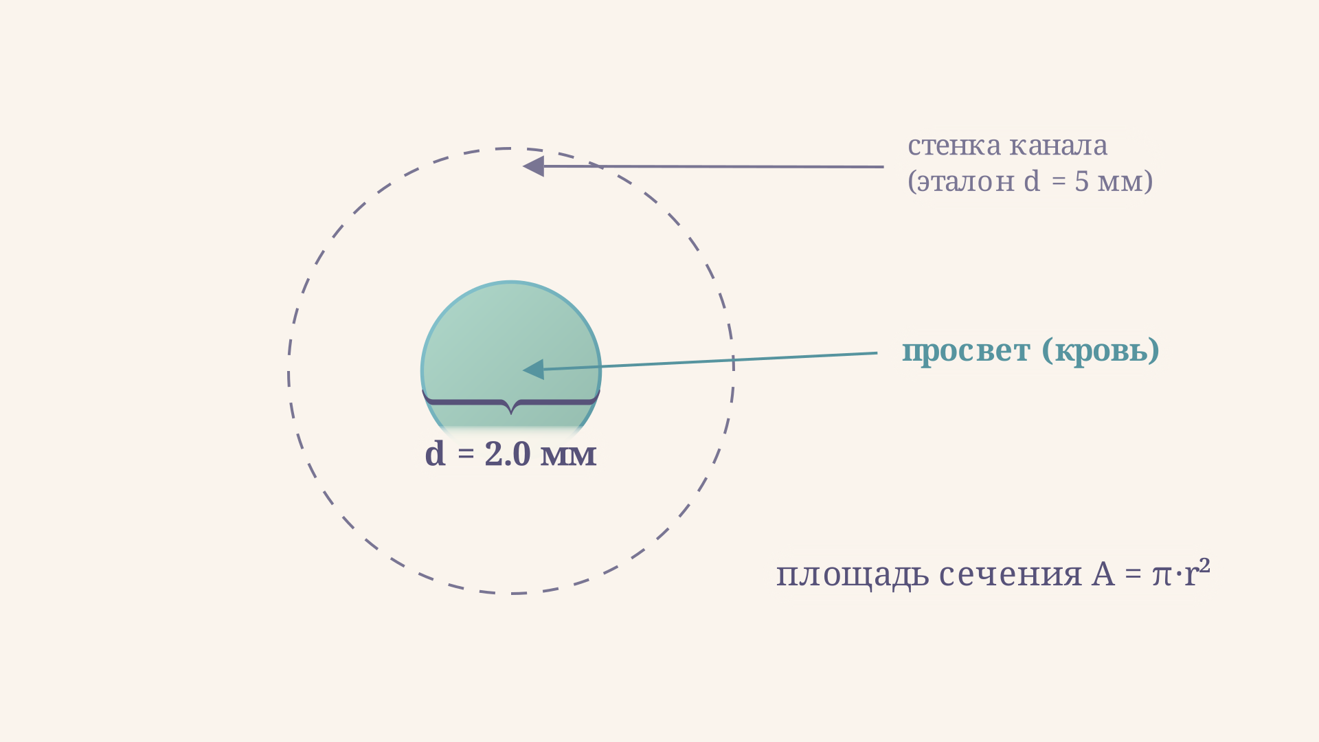 Поперечный разрез просвета мыщелкового канала: внешний контур - стенка канала, внутренний круг - заполненный кровью просвет, площадь которого определяет расход