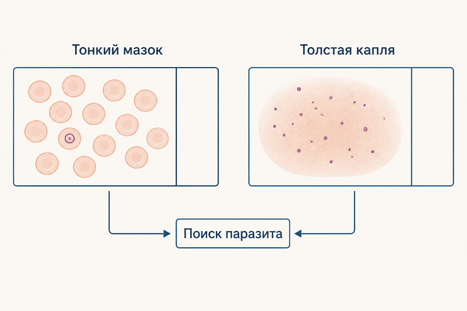 Сравнение тонкого мазка и толстой капли: тонкий препарат сохраняет форму клеток, толстая капля помогает искать паразита