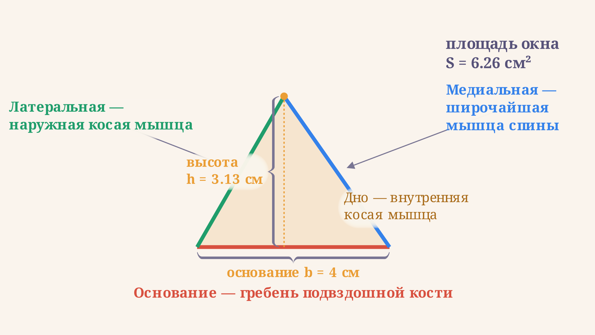 Схема поясничного треугольника Пти: основание на гребне подвздошной кости, латеральная сторона из наружной косой мышцы, медиальная из широчайшей мышцы спины, в дне внутренняя косая мышца
