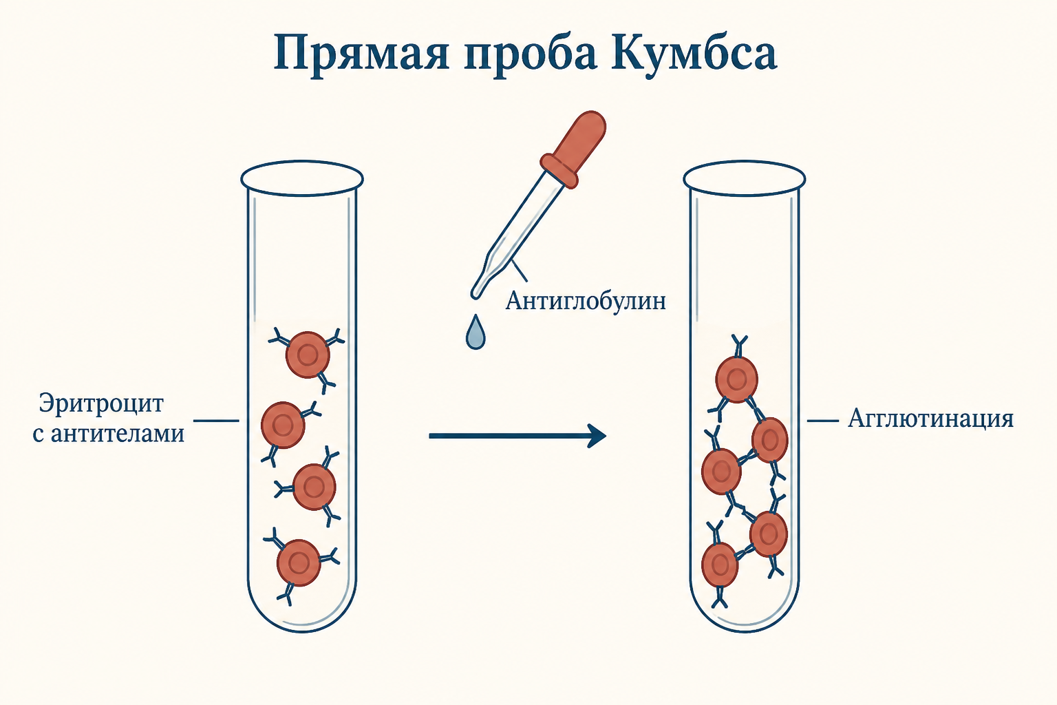 Прямая проба Кумбса: эритроциты пациента уже несут антитела, а добавленный антиглобулин стягивает их в видимый осадок за один шаг
