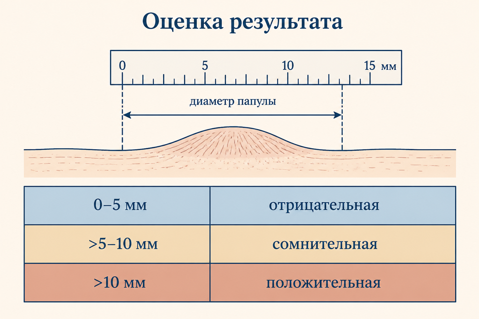 Оценка результата: прозрачной линейкой измеряют поперечный диаметр папулы в миллиметрах, по нему определяют отрицательную, сомнительную или положительную реакцию