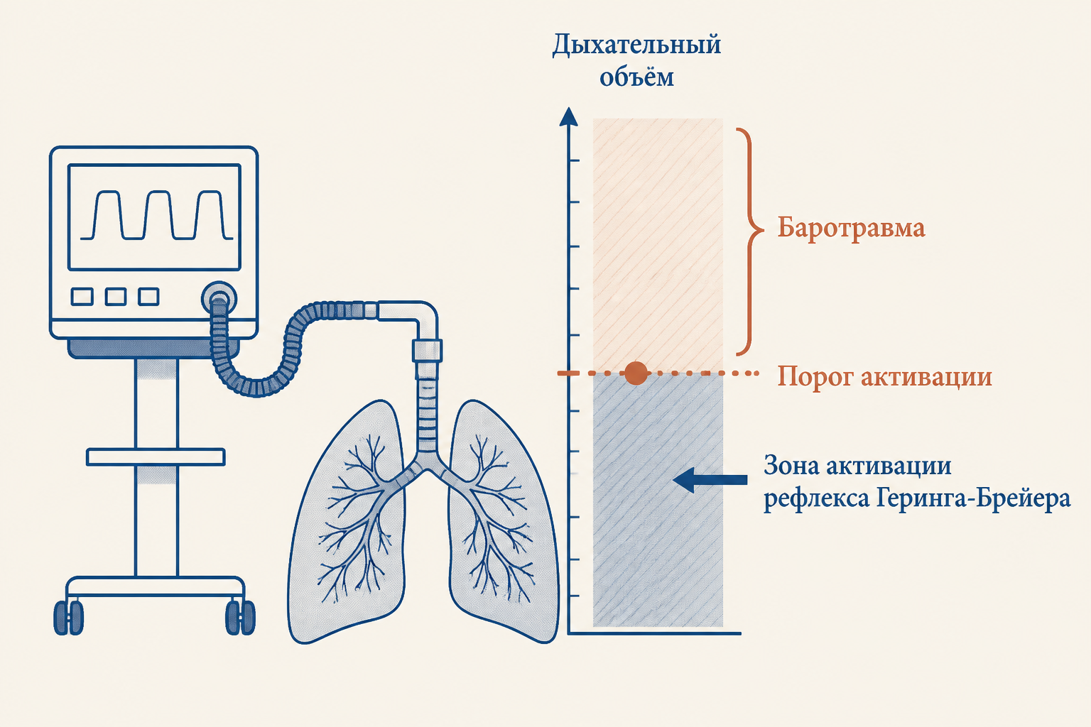 Клиническое применение: настройки объёма при ИВЛ и пороги рефлекса