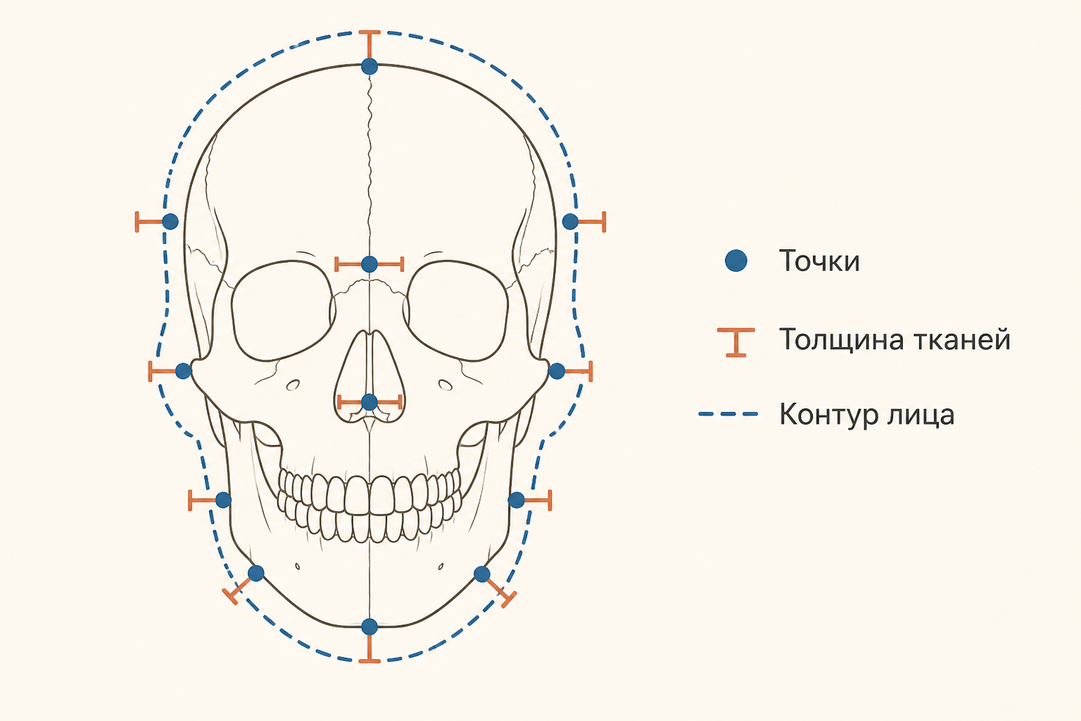 Схема: точки на черепе задают среднюю толщину мягких тканей и вероятный контур лица
