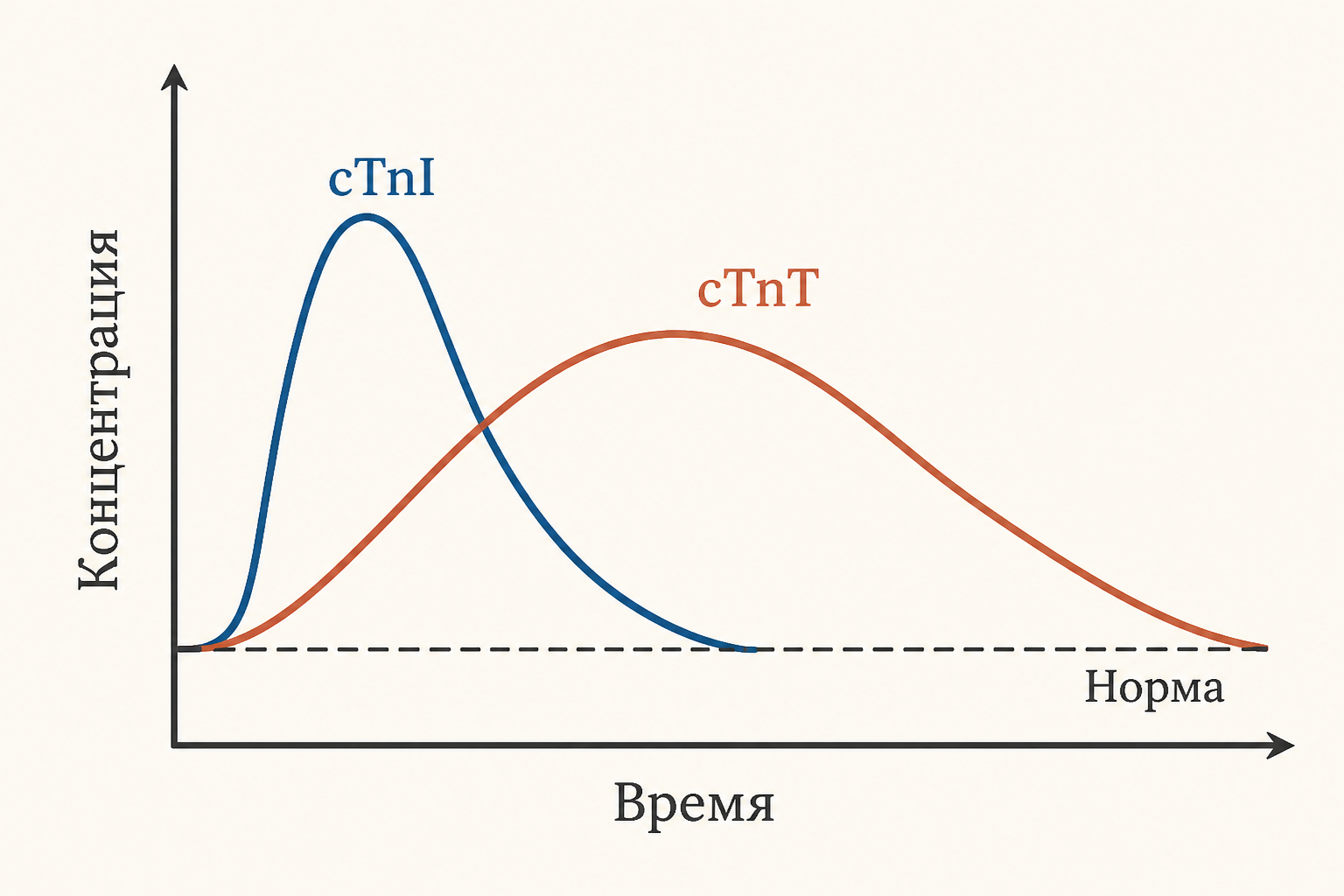 Сердечный тропонин в крови: временная динамика cTnI и cTnT при инфаркте миокарда