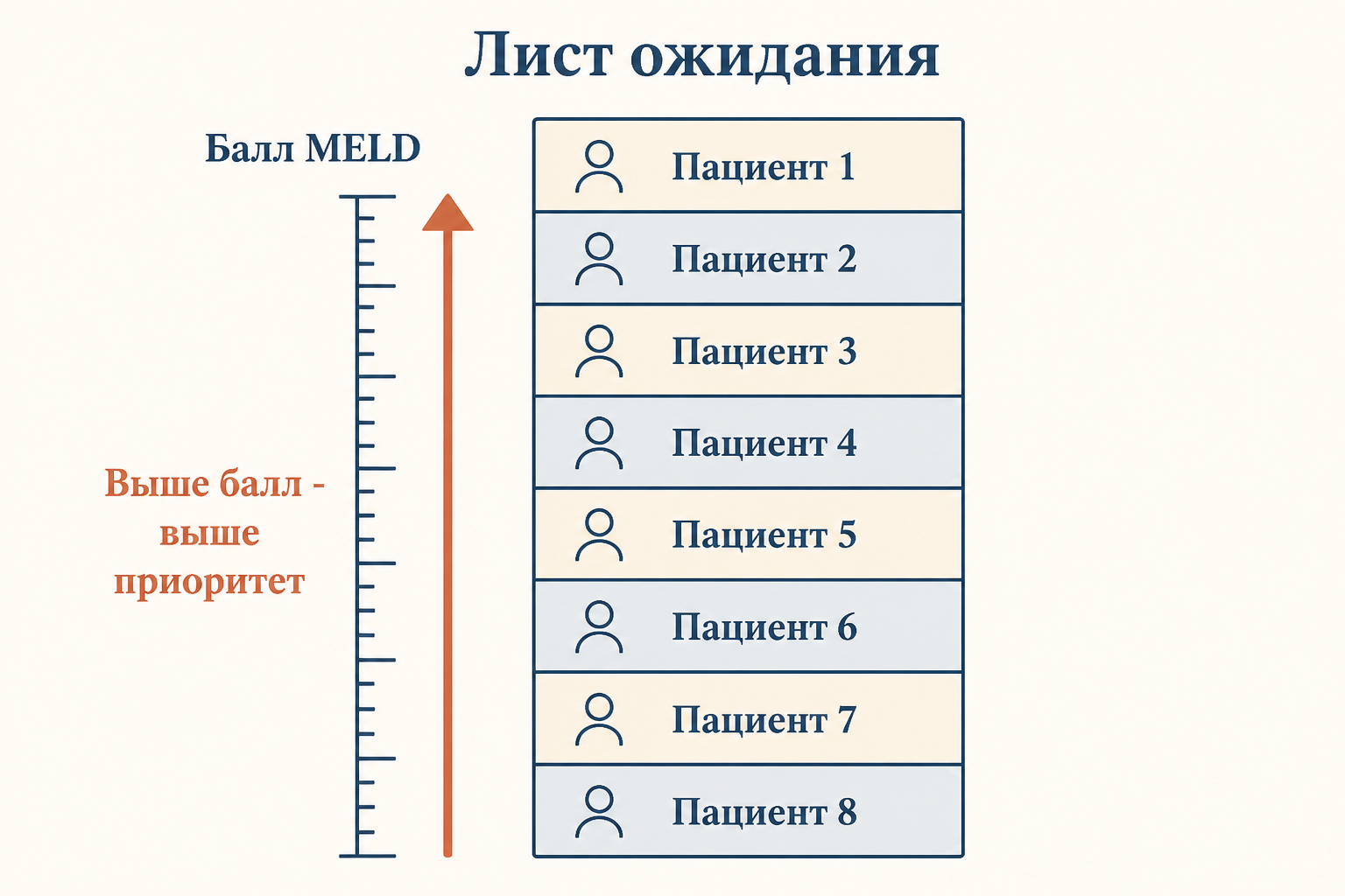 Лист ожидания трансплантации: чем выше балл MELD, тем выше приоритет пациента на получение донорской печени