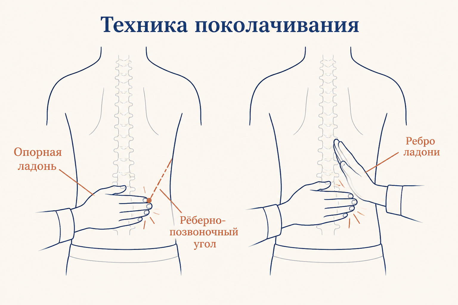 Техника поколачивания по пояснице: опорная ладонь кладётся на рёберно-позвоночный угол, по ней наносят лёгкий удар ребром второй кисти.