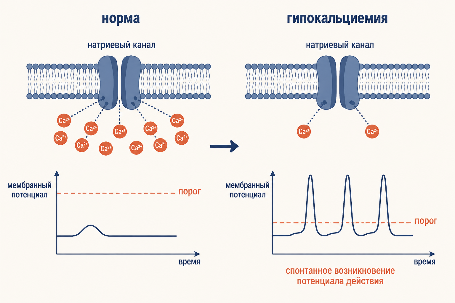 Схема: ионы кальция экранируют натриевые каналы; при гипокальциемии порог снижается и нерв возбуждается от слабого стимула