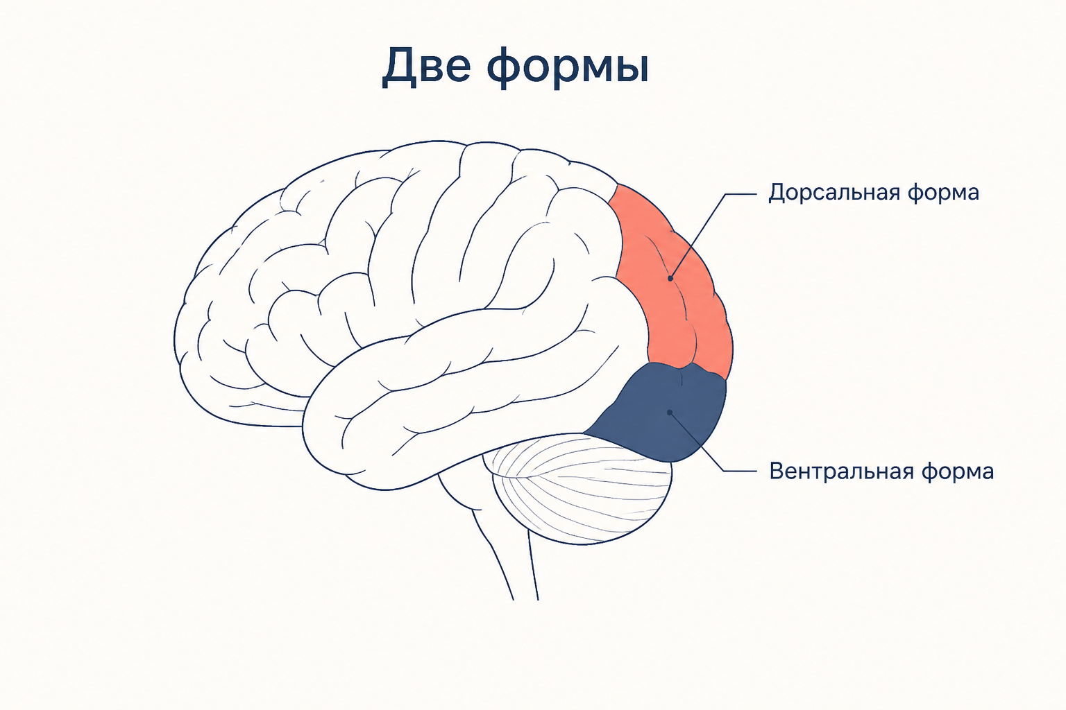 Две формы симультанной агнозии: дорсальная при теменно-затылочном поражении и вентральная при левом височно-затылочном