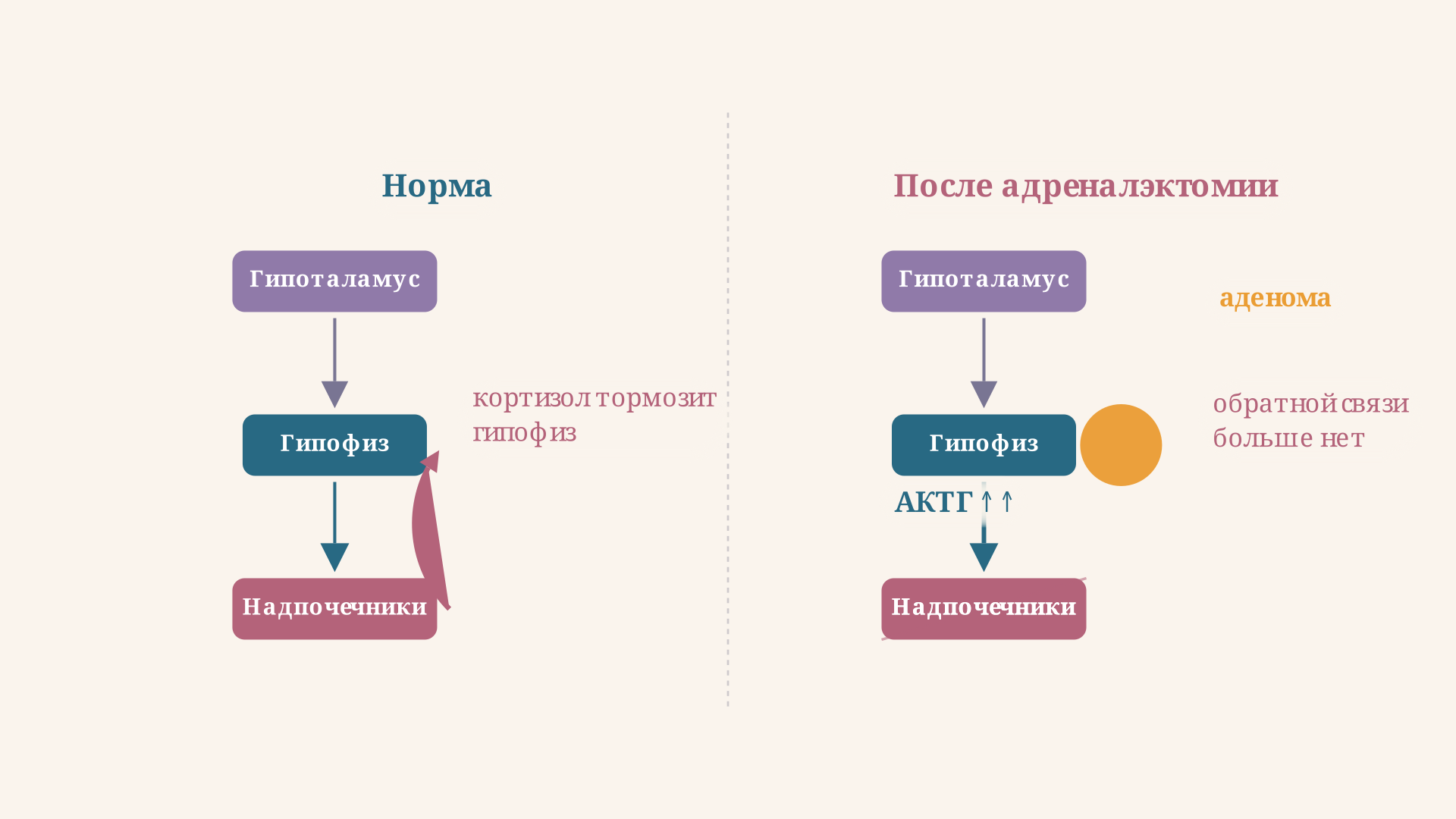 Петля обратной связи гипоталамус-гипофиз-надпочечники: пока надпочечники на месте, кортизол тормозит гипофиз; после адреналэктомии стрелка торможения исчезает и аденома растёт