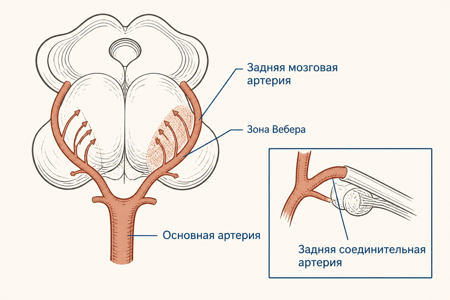 Зоны кровоснабжения среднего мозга: парамедианные ветви и ножка мозга