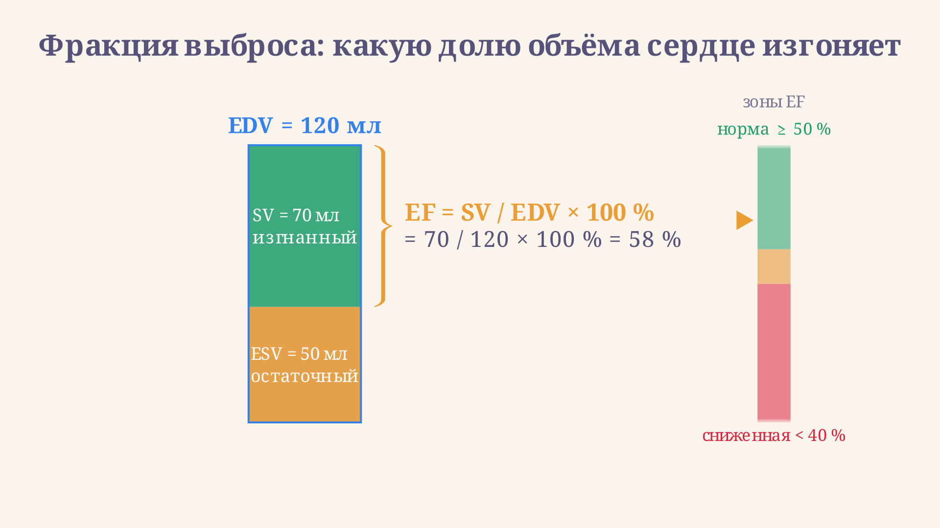 Состав конечно-диастолического объёма: остаточный объём ESV плюс изгнанный ударный объём SV; их отношение к полной высоте столбца и есть фракция выброса