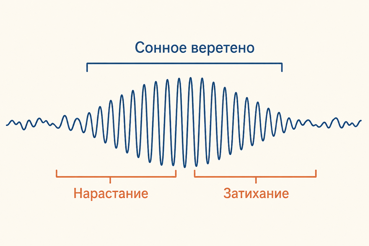 Схема сонного веретена: сигма-ритм постепенно нарастает и затихает на фоне ЭЭГ сна