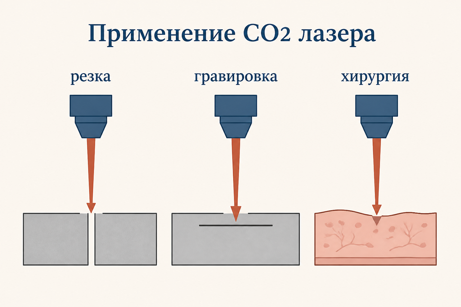 Применение CO2 лазера: резка металла, гравировка поверхности и хирургия мягких тканей сфокусированным инфракрасным лучом