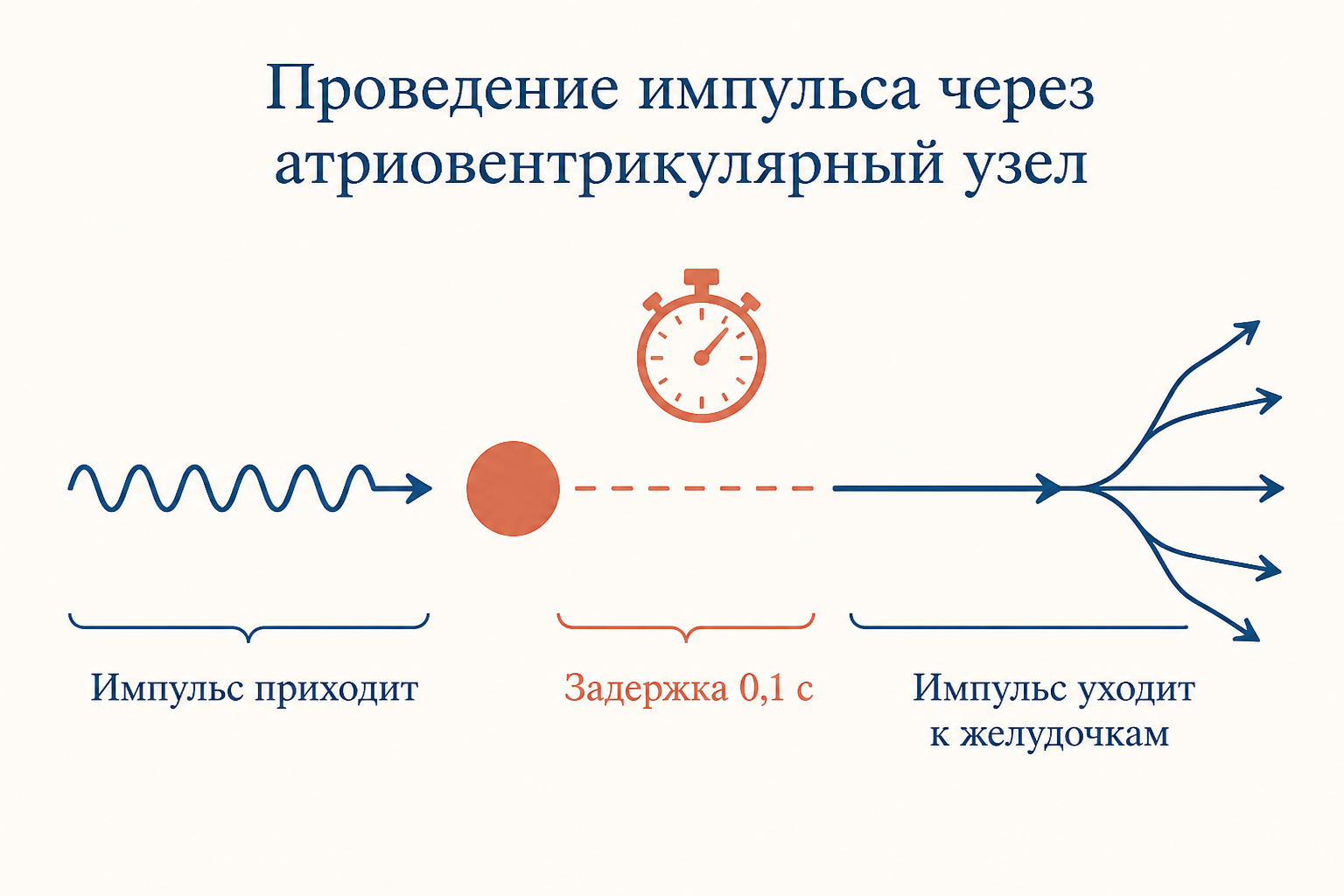 Схема проводящей системы сердца: синусовый узел вверху правого предсердия, узел Ашоффа-Тавара на границе с желудочками, пучок Гиса с ножками. Терракотовым выделена точка задержки импульса.