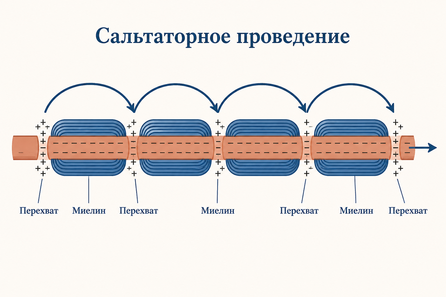 Схема сальтаторного проведения по миелинизированному волокну: перехваты Ранвье и прыжки локального тока
